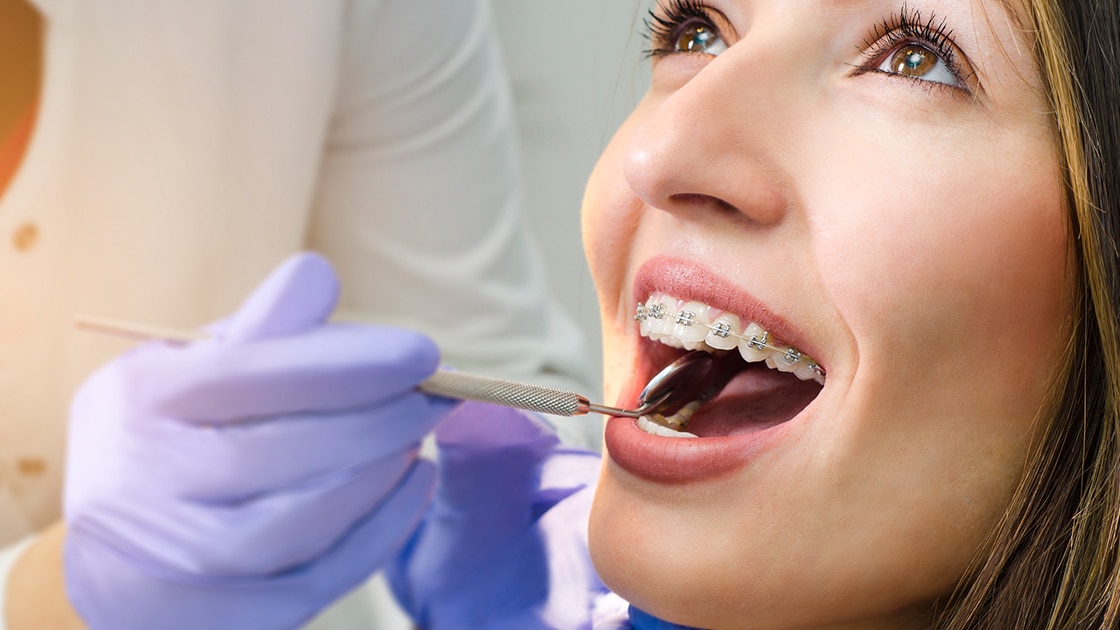 Orthodontic Patient Smiling